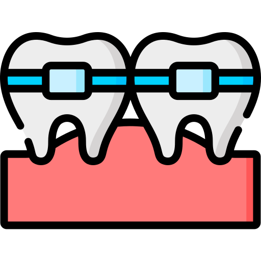 Braces Treatment